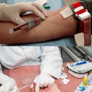 Co je krevní test určuje červy u dítěte a dospělého obecnou IFA, ze žíly?