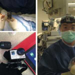 GoPro kamera trénovat chirurgy