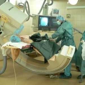 Počítač angiografie: Studium metodou přidání, technika