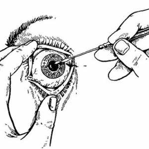 Léčba na stupních lékařskou evakuaci s lézí orgánu zraku. Se zničením oční bulvy
