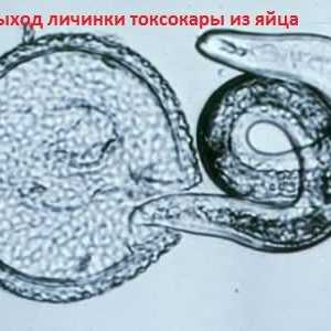 Larvy a vajíčka Toxocara viscerální larvální toxokaróza