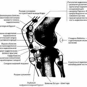 Záření a instrumentální diagnóza kolenního kloubu patologie