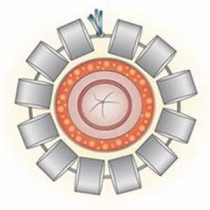Magnetický fenix systém eliminuje fekální inkontinence