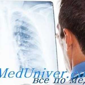 Mechanismy astmatu. patogeneze