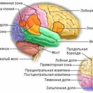 Metastatické nádory mozku