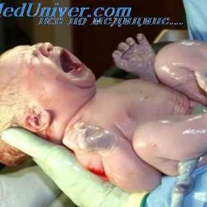 Přechod do spontánního dýchání novorozence. Vyhlazení plíce po porodu