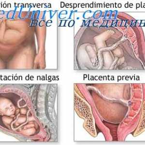 Mechanismy porodem. Hormony vliv na dělohu