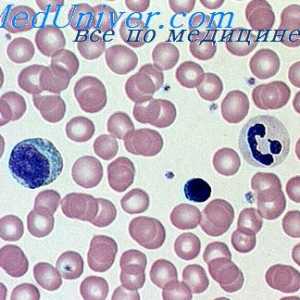 Zničení hemoglobinu. Různé anémií
