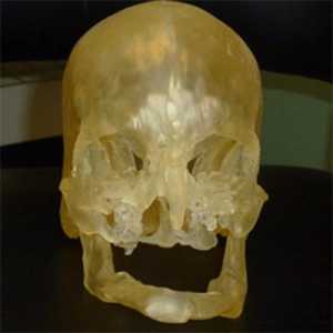 Vzorem pro transplantaci obličeje lze vytisknout na 3D tiskárně