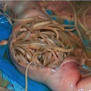 Může být červi v žaludku člověka?