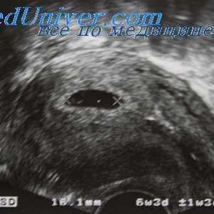 Je nutné provést ultrazvuk každý těhotná. Pokud je to nezbytné ultrazvuk screening těhotných žen?