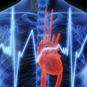 Porušení srdečního vedení, srdeční zástavy, nohy, léčba, symptomy, příčiny