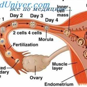 Abnormální umístěte implantaci embrya. Vaječníků a břišní těhotenství
