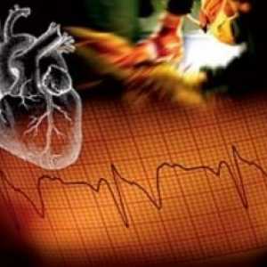 Mimořádné události v kardiologii: léčba