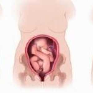 Špatného postavení a prezentace plodu během těhotenství