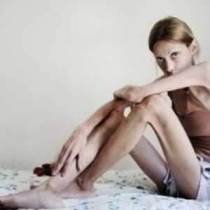 Mentální anorexie: léčba, příznaky, znaky, příčiny