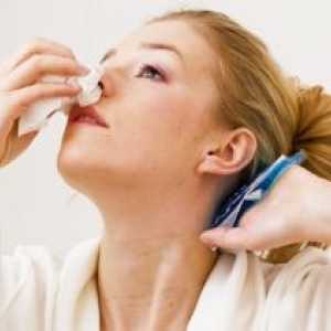 Krvácení z nosu (epistaxe) v těhotenství: příčiny, léčba
