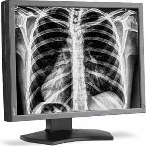 Nový monitor pro radiology