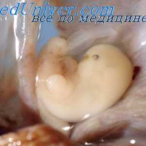 FIELD nohy fetálního mozku. Vývoj plodu epithalamus