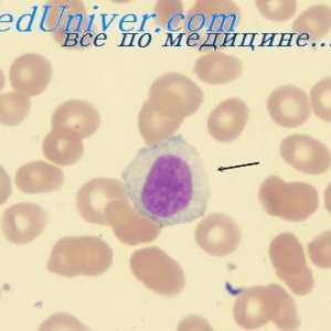 Imunita tělo. lymfatické tkáně