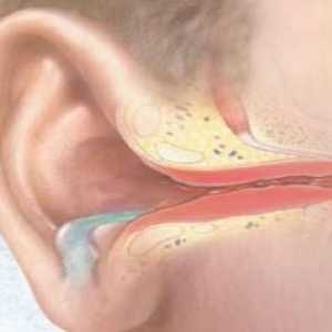 Akutní hnisavý zánět středního ucha: léčba, příznaky, znaky, příčiny