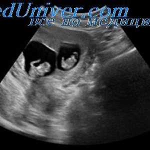 Odražené ultrazvukové vlny. Generace a detekce ultrazvuku