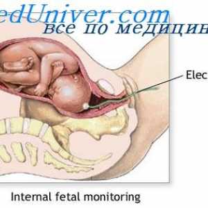 Odloučení a porod placenty. Bolesti při porodu