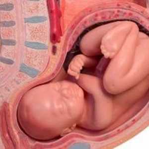 Odtržení placenty během těhotenství: příznaky, příčiny, léčba, příznaky, komplikace