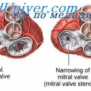 Restrukturalizaci oběhu plodu. embryo trénink plavidlo