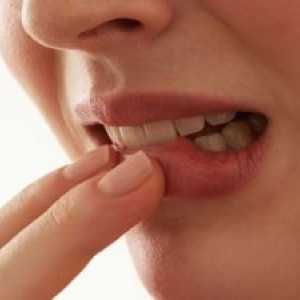 Spinocelulární karcinom ústní dutiny: léčba, příznaky, prognóza