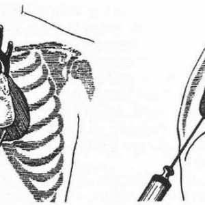 Poškození vnitřních orgánů v poranění hrudníku