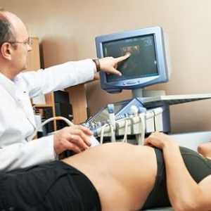 Molární těhotenství Během těhotenství, příznaky, symptomy, příčiny, léčba
