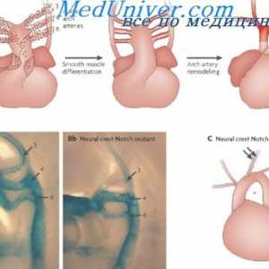Vývoj arteriální cévní systém. Fáze tvorby plodu aortu