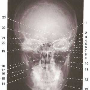 Lebky X-ray anatomie