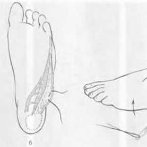 Scar deformity nohy a kotníku. Léčebné vady povrchu plosky nohy