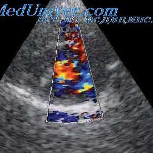 Jádro střídače. ultrazvukové pole