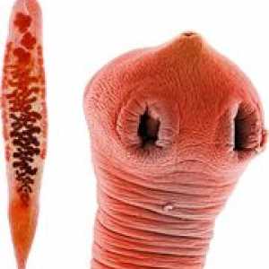 Příznaky červi (helminti) a žlučové kanálky