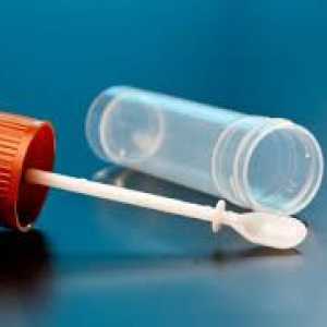 Škrábání na enterobiózy, Pinworm vejce na analýze dospělých a dětí