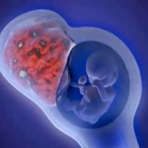 Tvorba děloze-placentární oběh