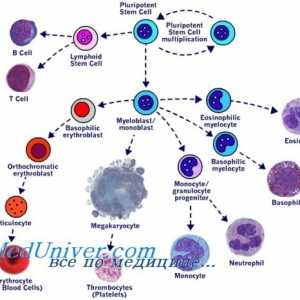 Transplantace kmenových buněk v myeloproliferativní onemocnění mieloleykoze