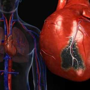 Traumatické poškození srdce a cév