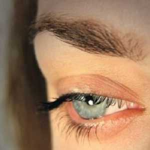 Poranění očí: léčba, první pomoc, příčiny, příznaky, znaky