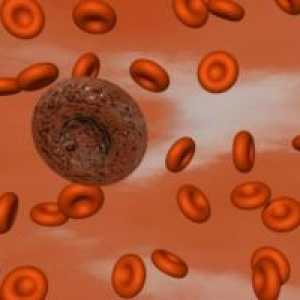 Krevních destiček Poruchy hemostázy, lze identifikovat?