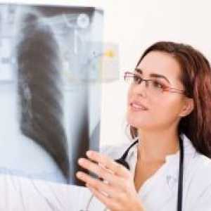 Plicní tuberkulózy v průběhu těhotenství, léčba, symptomy, příčiny