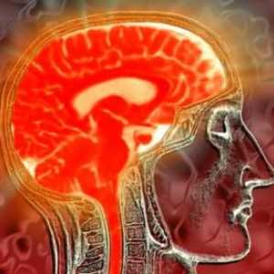 Tuberkulózní zánět mozkových blan, poškození centrálního nervového systému