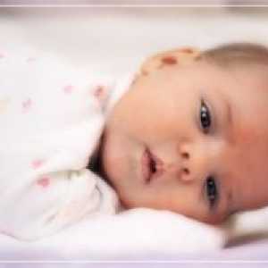 Nitrolební porodní trauma novorozence