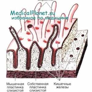Přirozená imunita střeva: část epitelu
