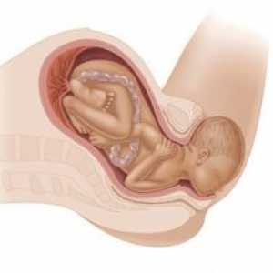 Druhá doba porodní: na začátku, v průběhu zavádění